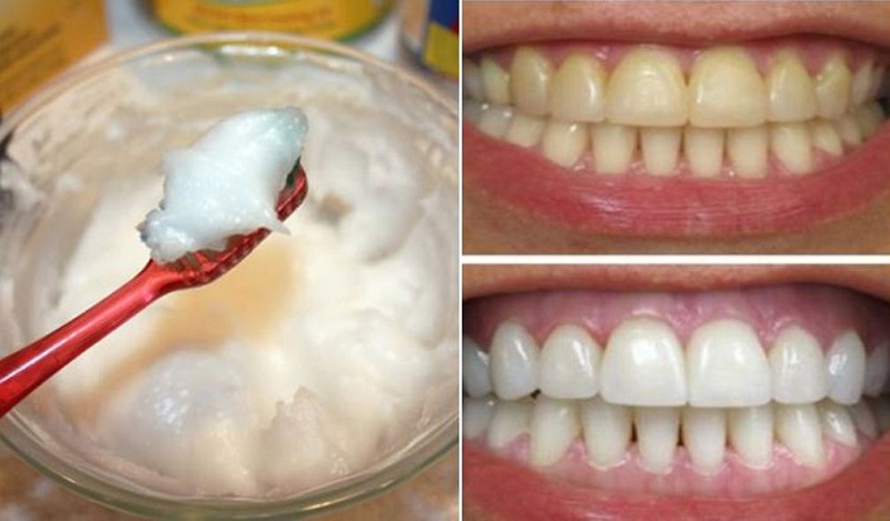 how to get your teeth white naturally fast